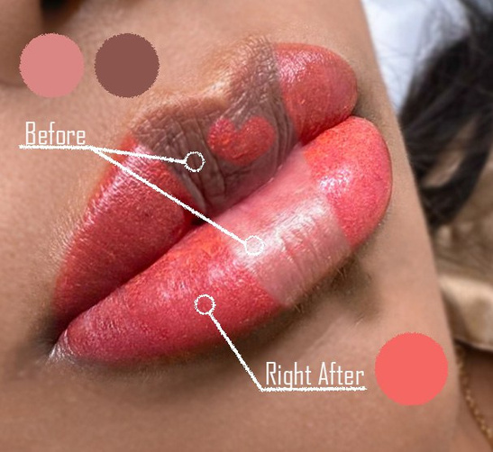 an image of lips with the words "before" pointing to natural brown pigment of lips and "after" showing post cosmetic tattoo pink color of lips.